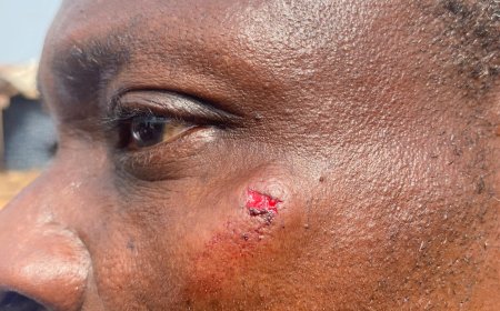 ELECTION 2024: Violence Erupts on Election Day in Ayomso: NPP Officer Allegedly Attacked by NDC Thugs