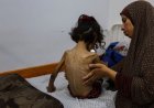 Famine Declared in Gaza as Over Half a Million Face Starvation
