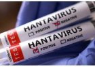 Ghana Health Service Strengthens Hantavirus Surveillance